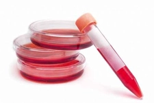 Beyaz Kan Düşüklüğü Nedenleri?